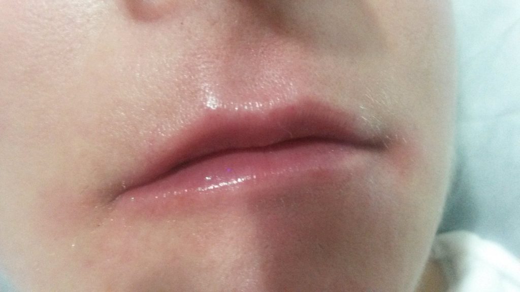 powiększanie, wypełnianie ust kosmetyczka w Kożuchowie - salon Visage